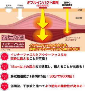 複合高周波